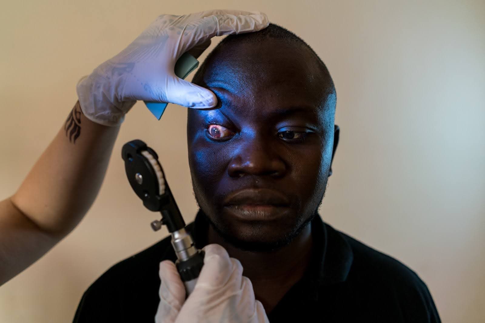 How to Sponsor a Free Cataract Surgery in Africa