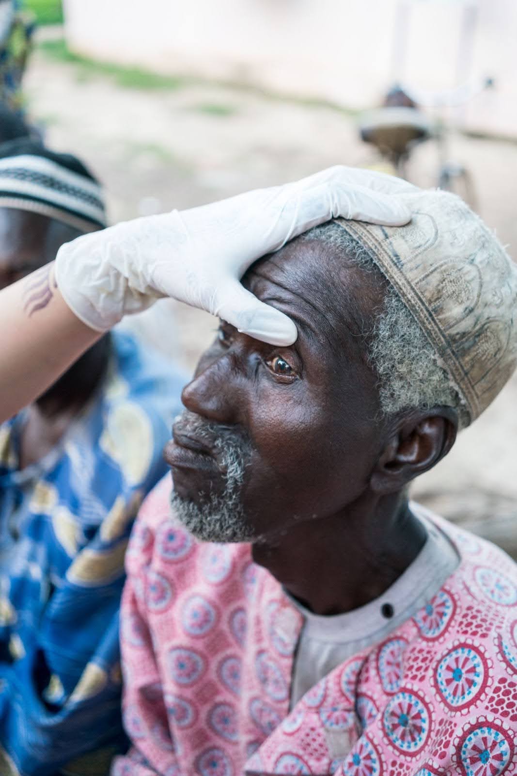 Cataracts in Mali: A Preventable Crisis with a Simple Solution